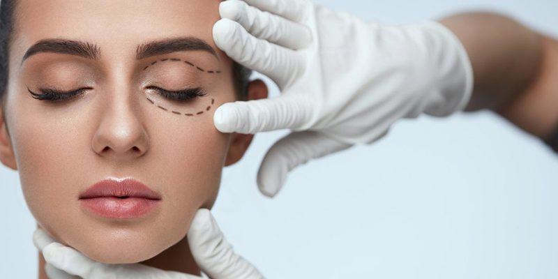 Blepharoplastik